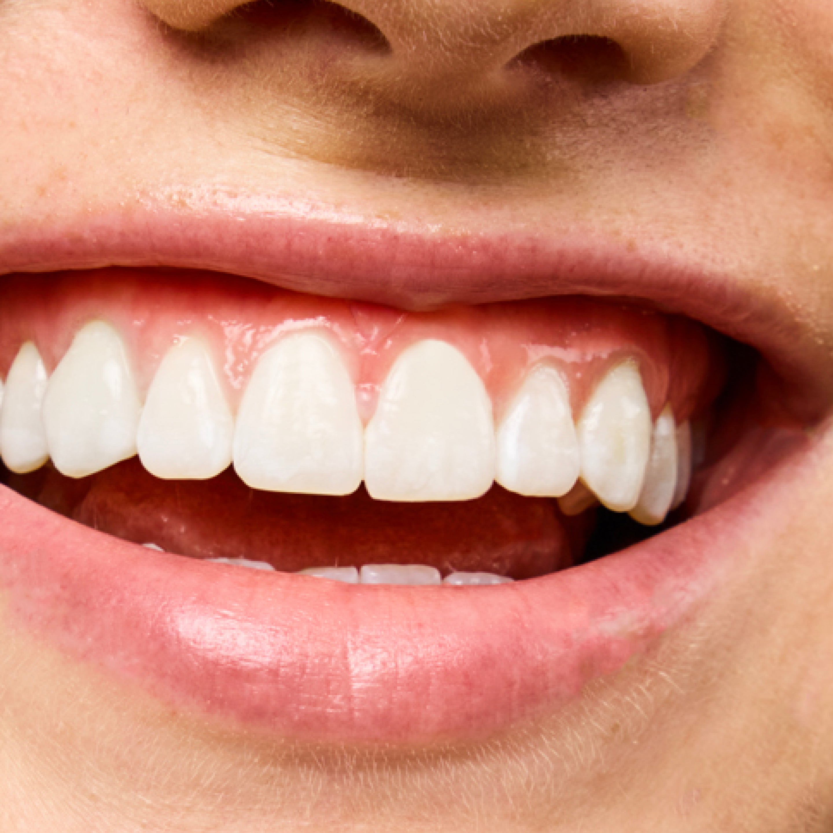 Close-up of a person's mouth with white teeth