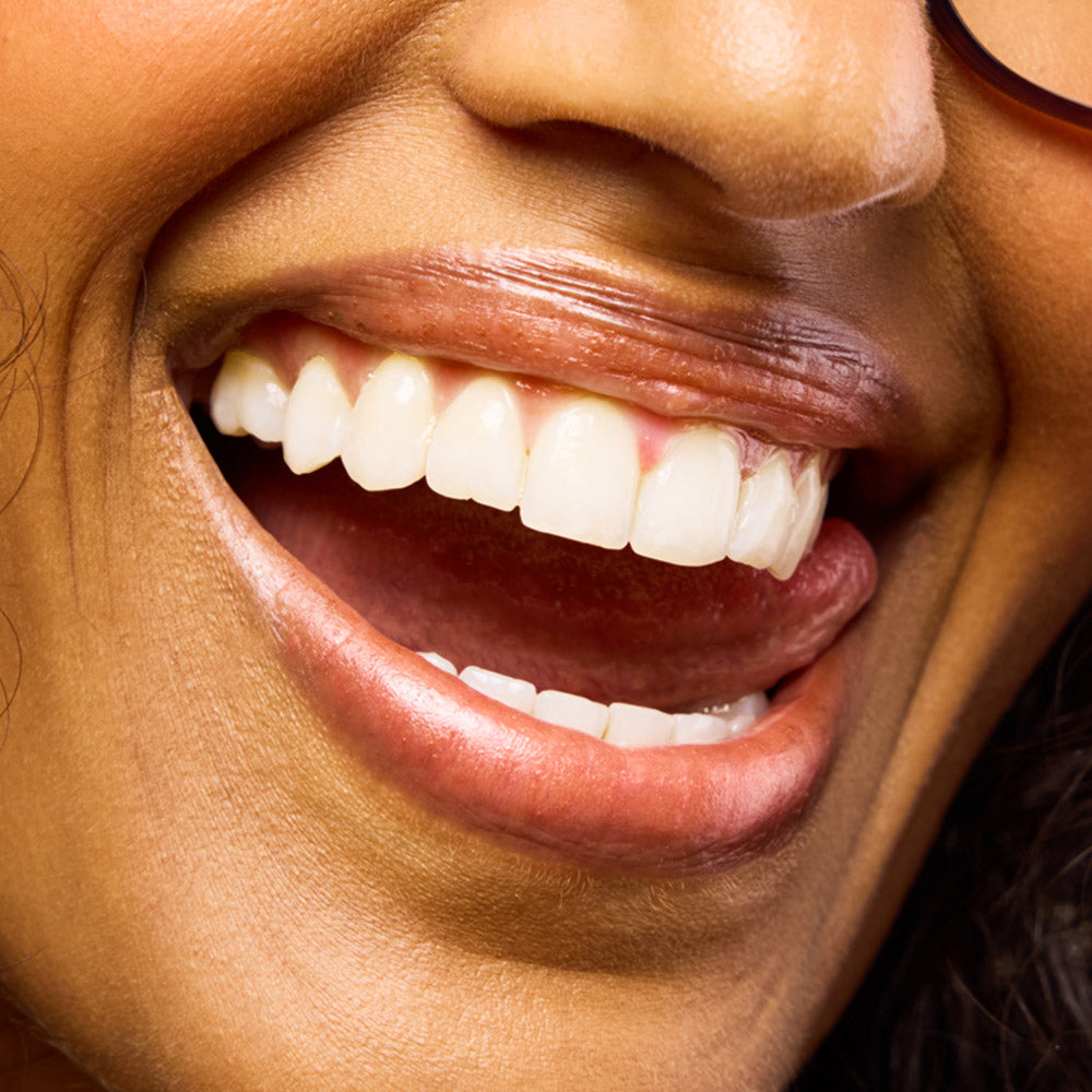Close-up of a person's smiling mouth with a focus on teeth.
