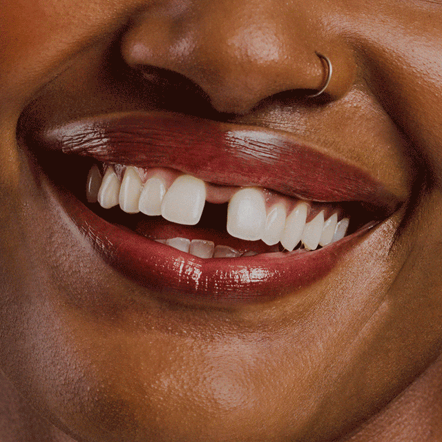 Close-up of a smiling person with healthy white teeth, showcasing confidence and dental care results. Desktop view